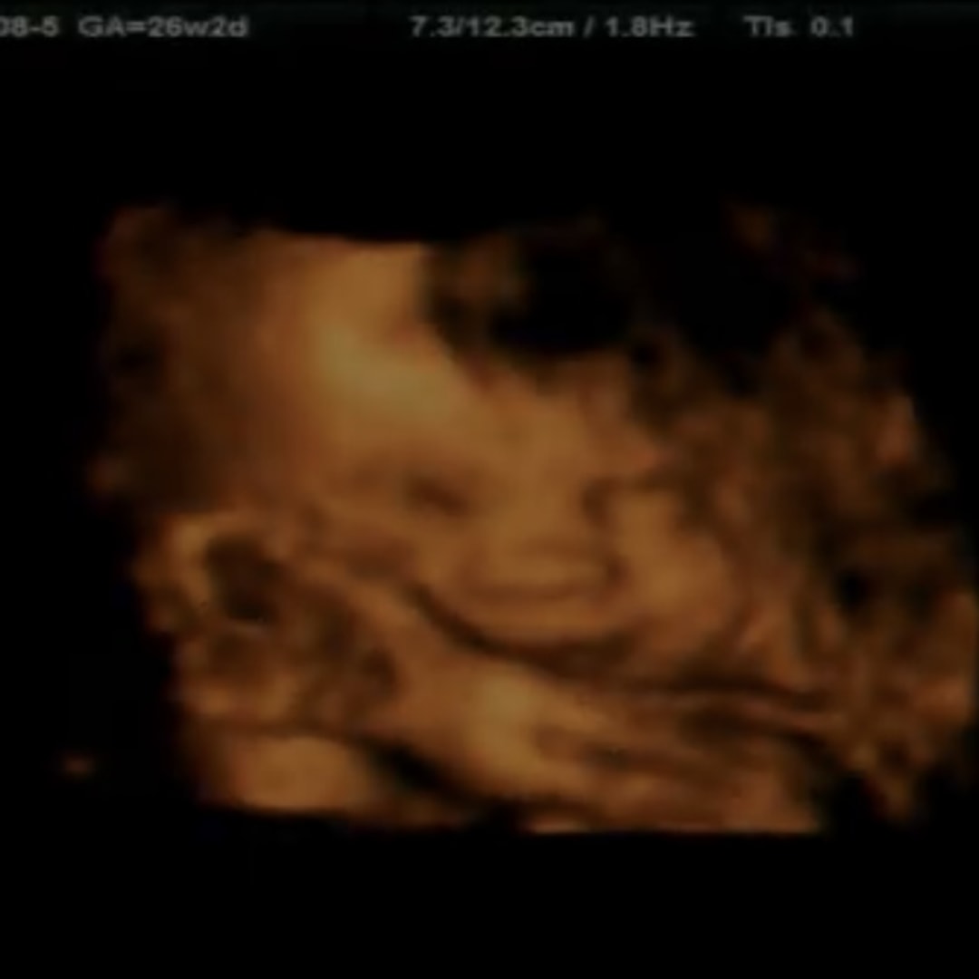 Photo shared by Markella for their Babylist baby registry.