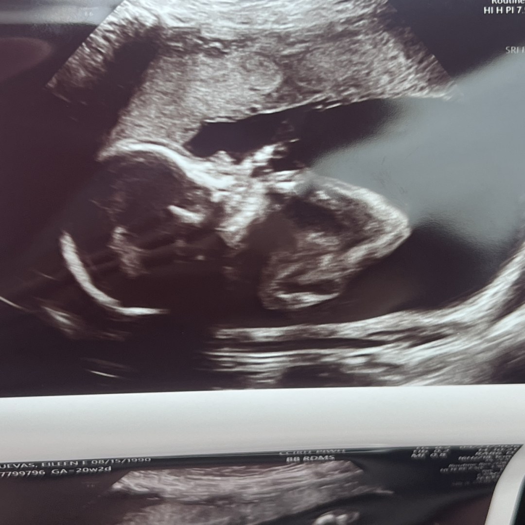 Photo shared by Eileen for their Babylist baby registry.