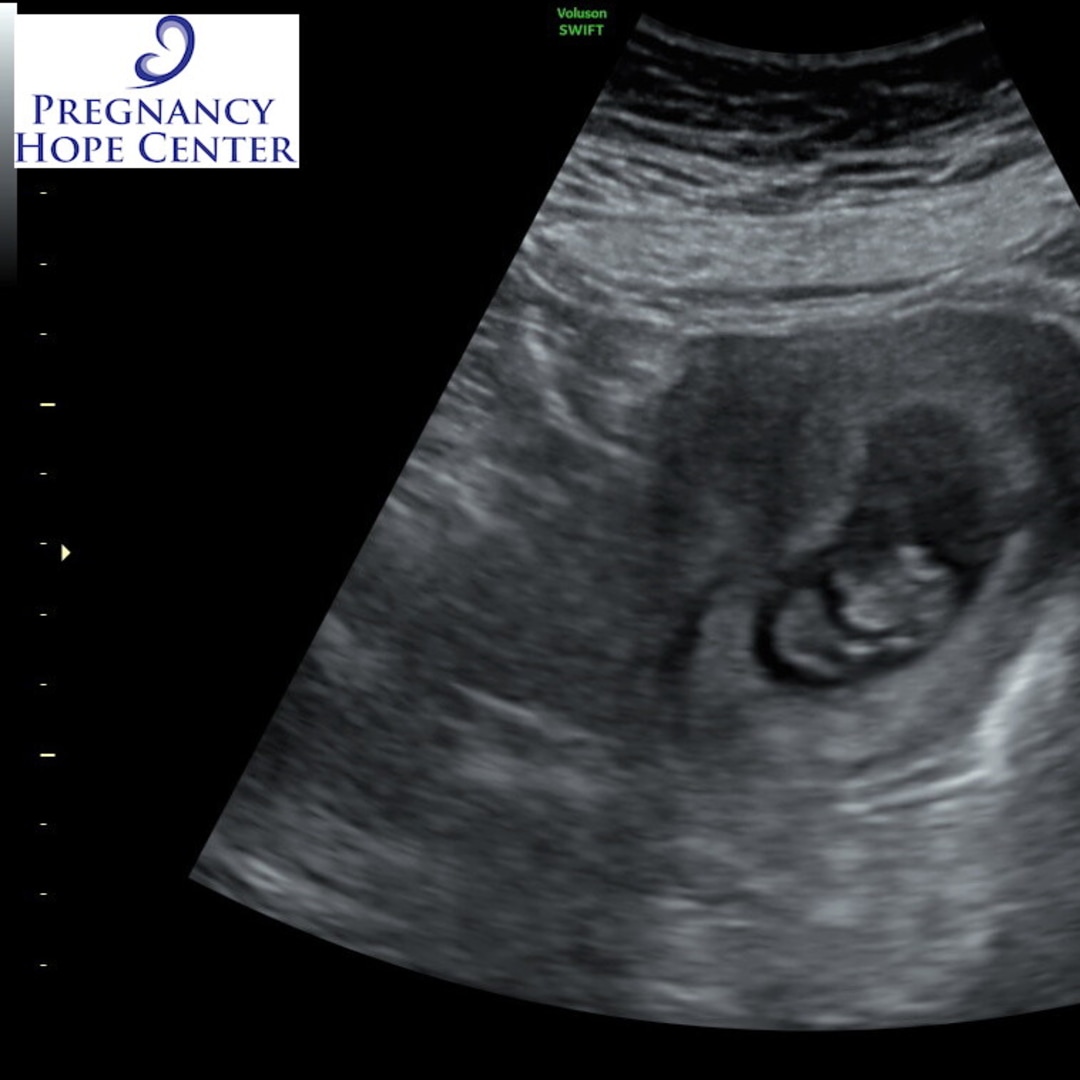 Photo shared by Rebekalyn for their Babylist baby registry.