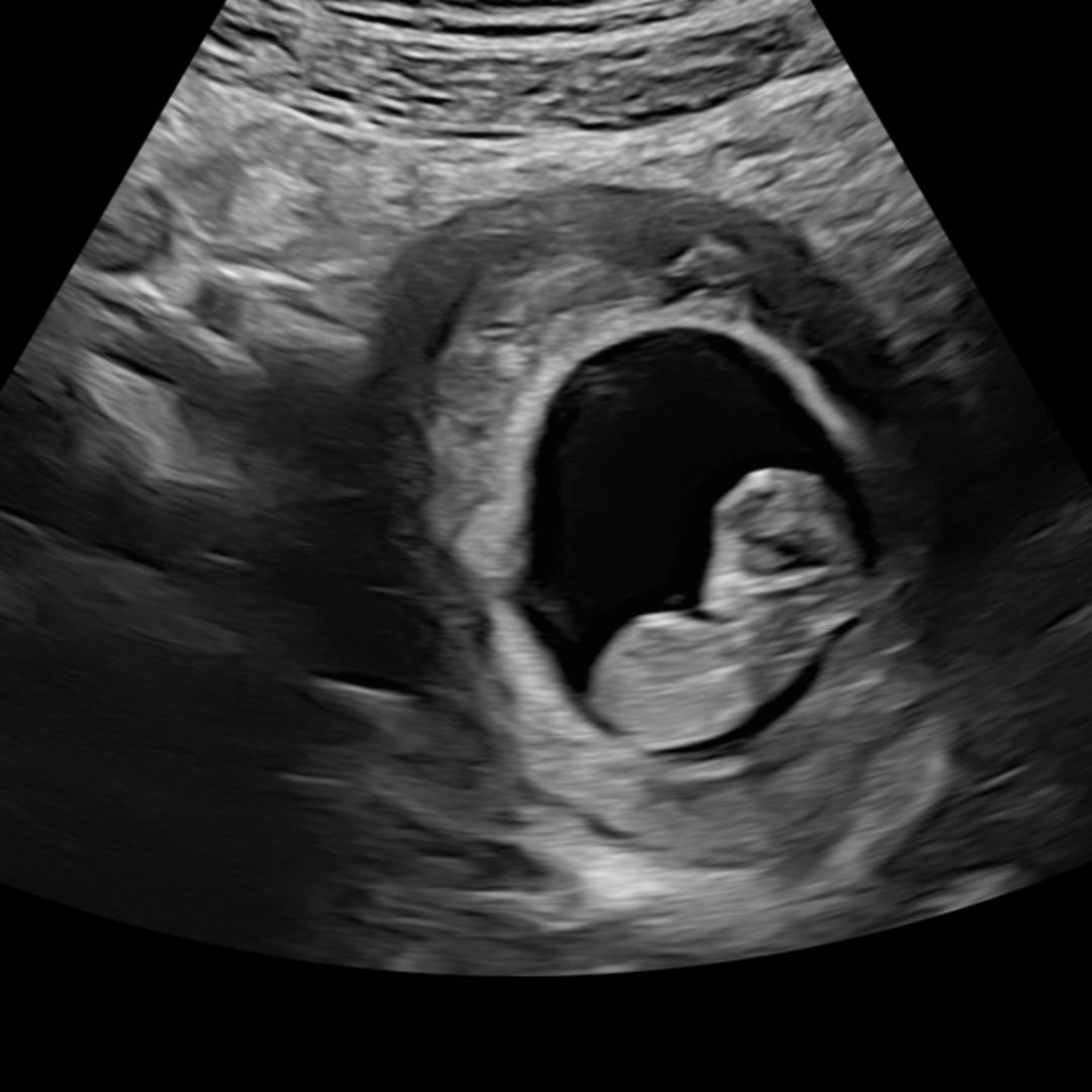 Photo shared by Dominica and Logan for their Babylist baby registry.