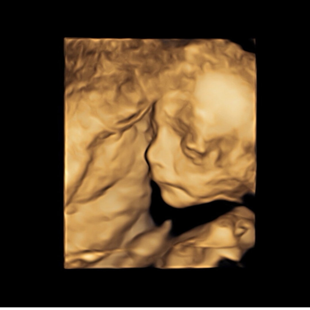 Photo shared by Sarah for their Babylist baby registry.