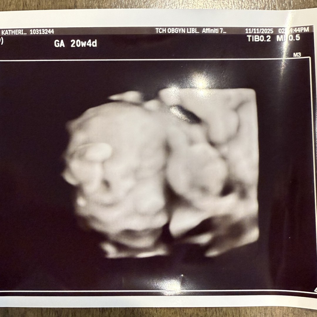 Photo shared by Kate for their Babylist baby registry.