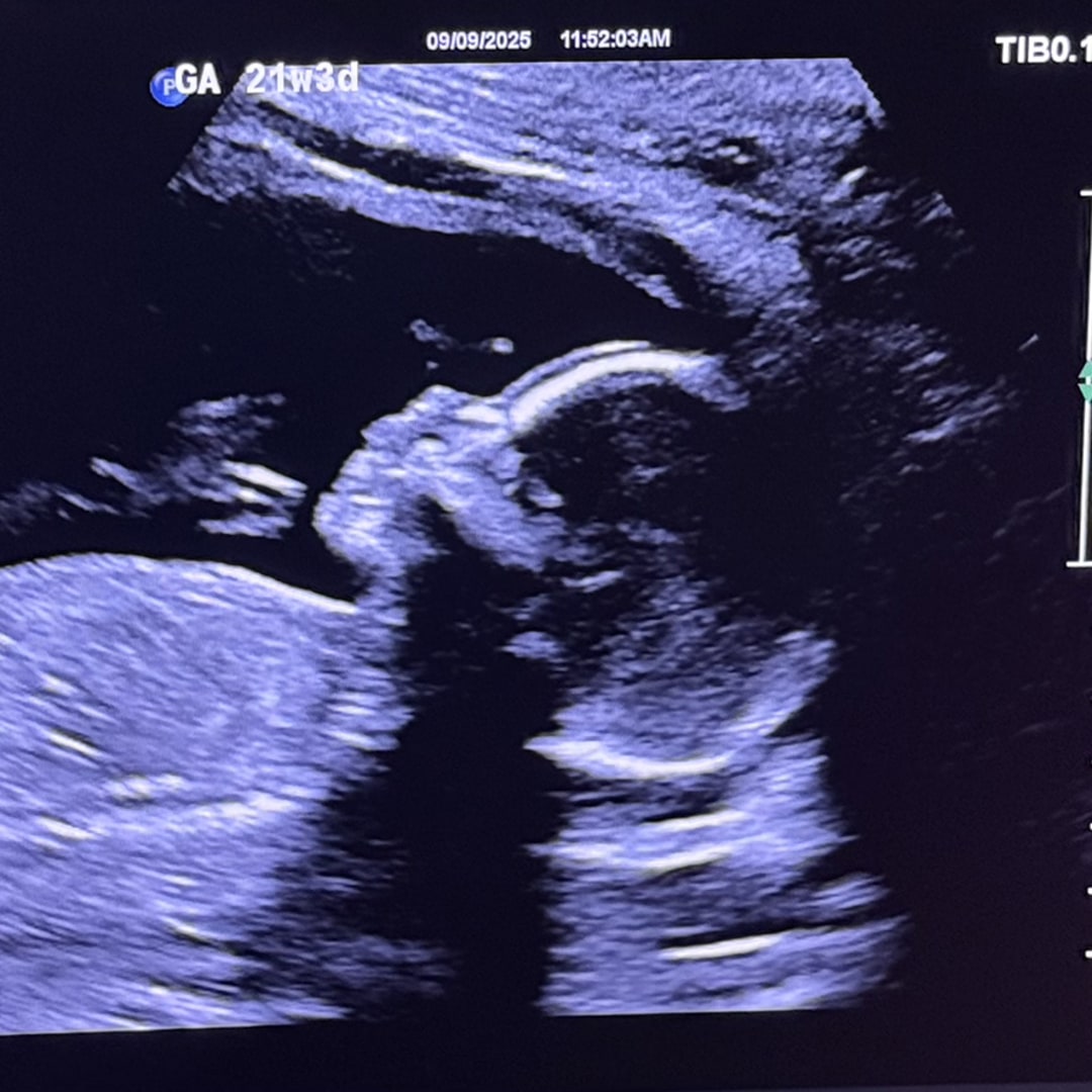 Photo shared by Savannah for their Babylist baby registry.