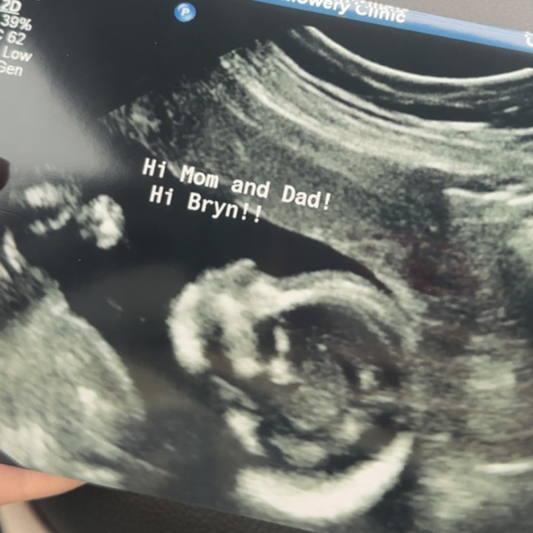 Photo shared by Starr for their Babylist baby registry.