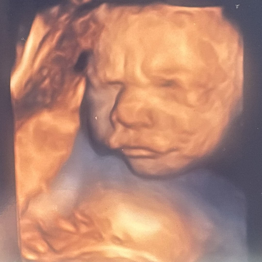 Photo shared by Breanna for their Babylist baby registry.