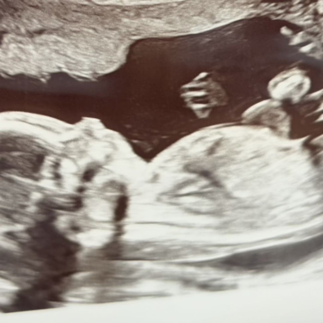 Photo shared by Morgan for their Babylist baby registry.