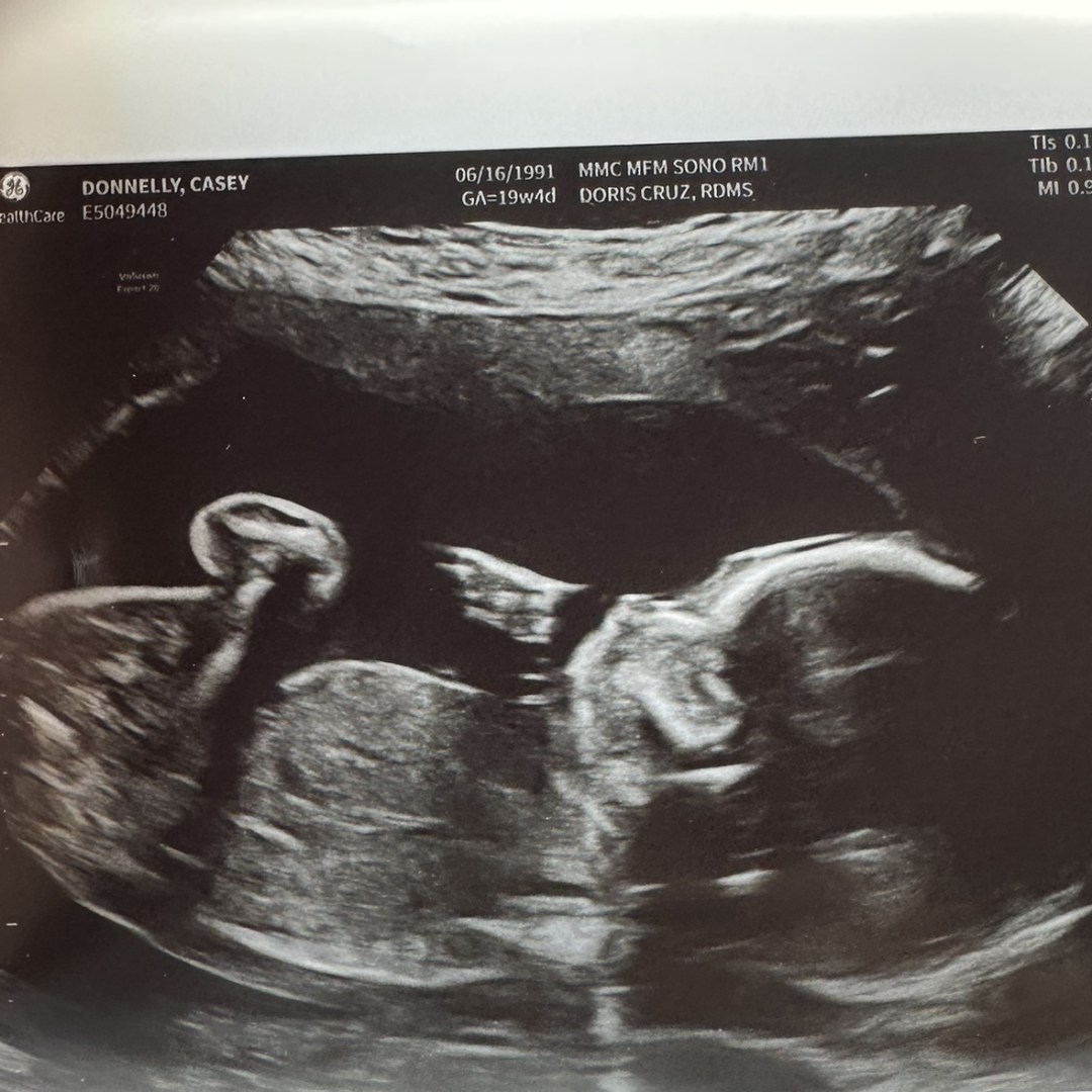 Photo shared by Casey for their Babylist baby registry.