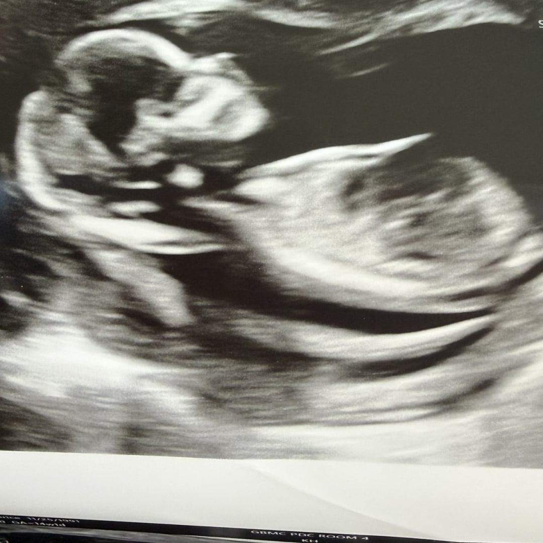 Photo shared by Cherice for their Babylist baby registry.