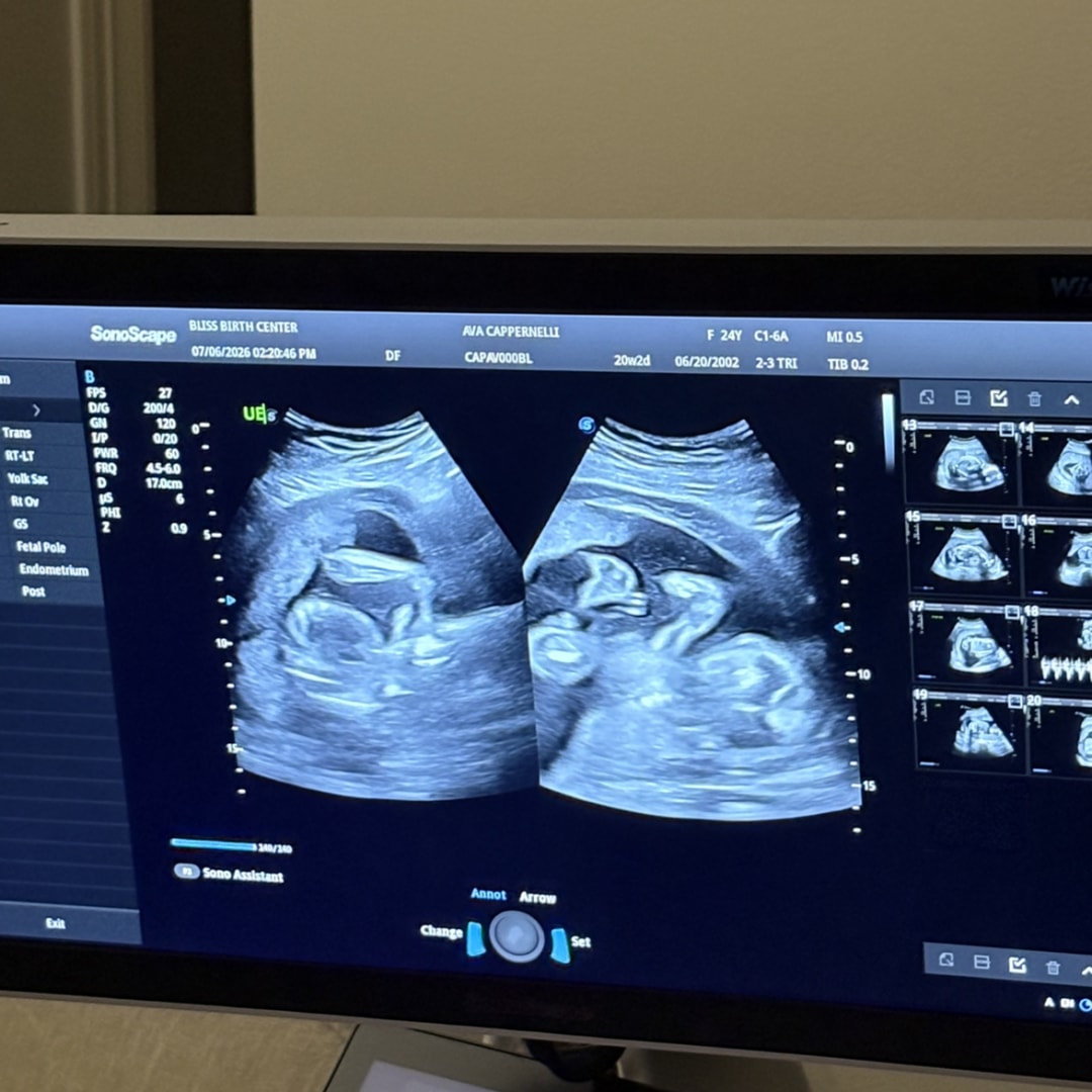 Photo shared by Ava for their Babylist baby registry.