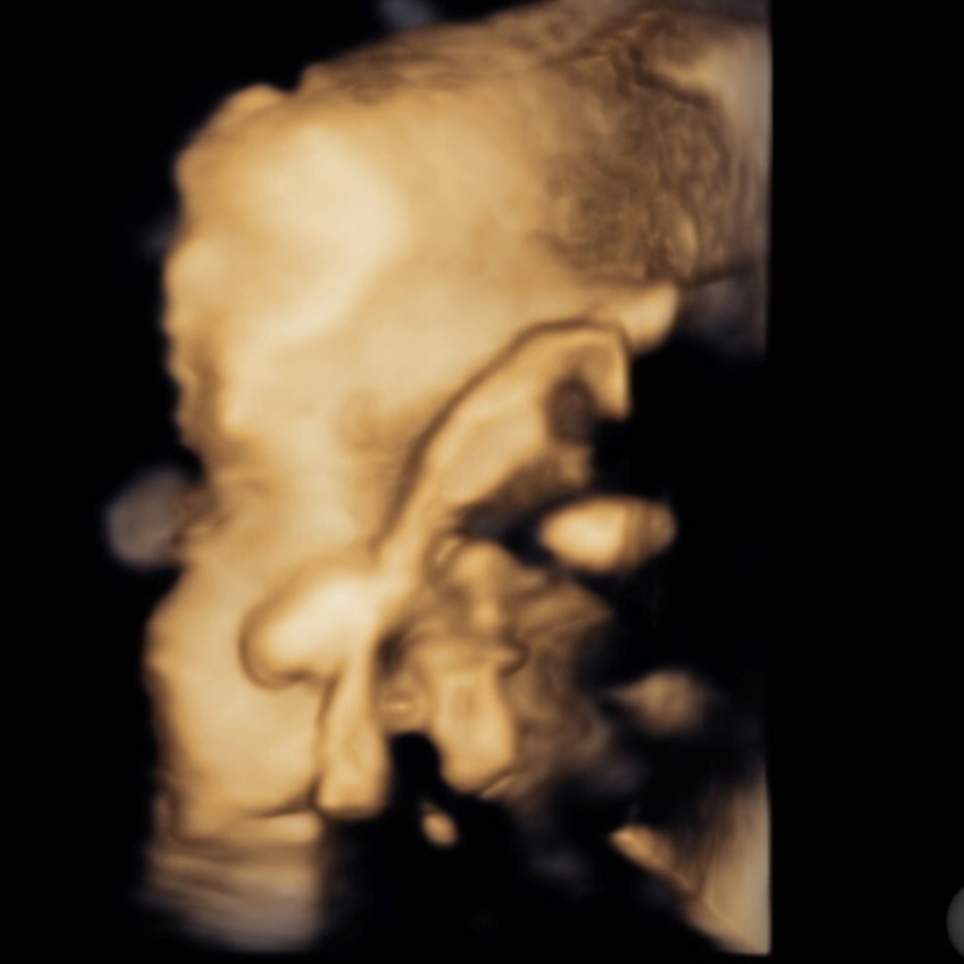 Photo shared by Nikk for their Babylist baby registry.