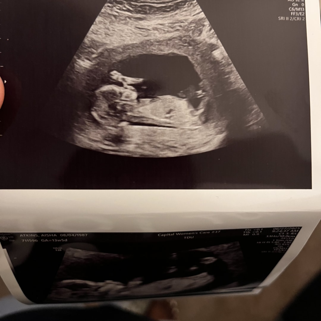 Photo shared by Aisha for their Babylist baby registry.