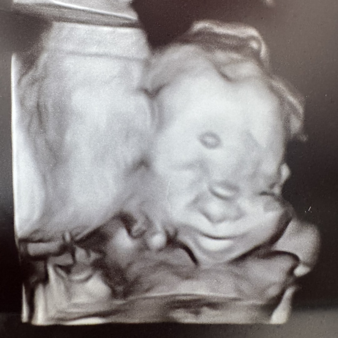 Photo shared by EveLynn for their Babylist baby registry.