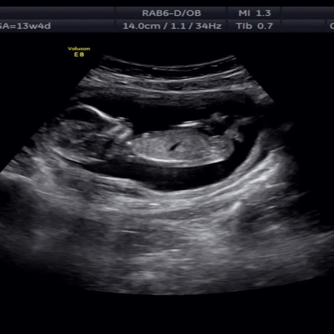 Photo shared by Taylor for their Babylist baby registry.