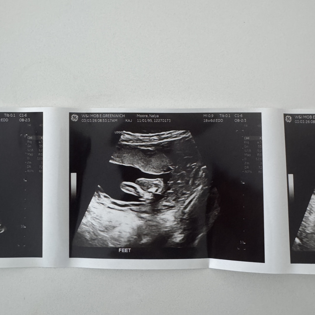 Photo shared by Nalya for their Babylist baby registry.