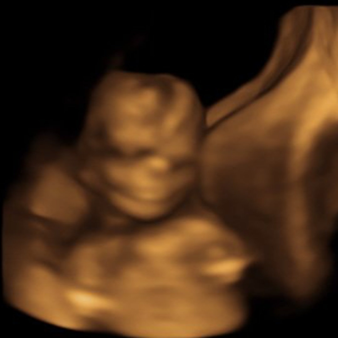 Photo shared by Erin for their Babylist baby registry.