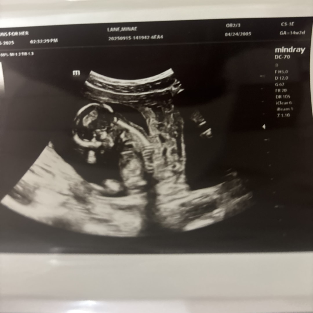 Photo shared by Minae for their Babylist baby registry.