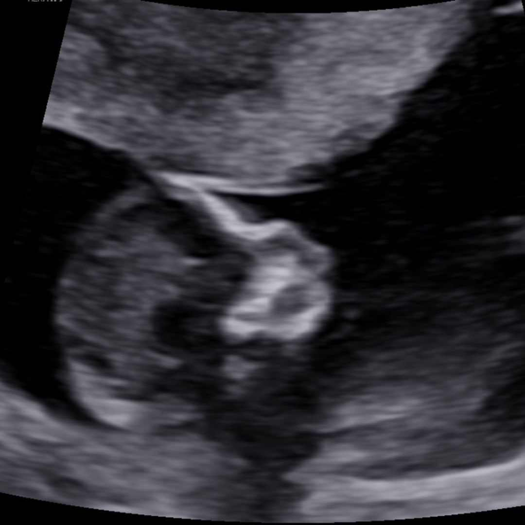 Photo shared by Adrianna for their Babylist baby registry.