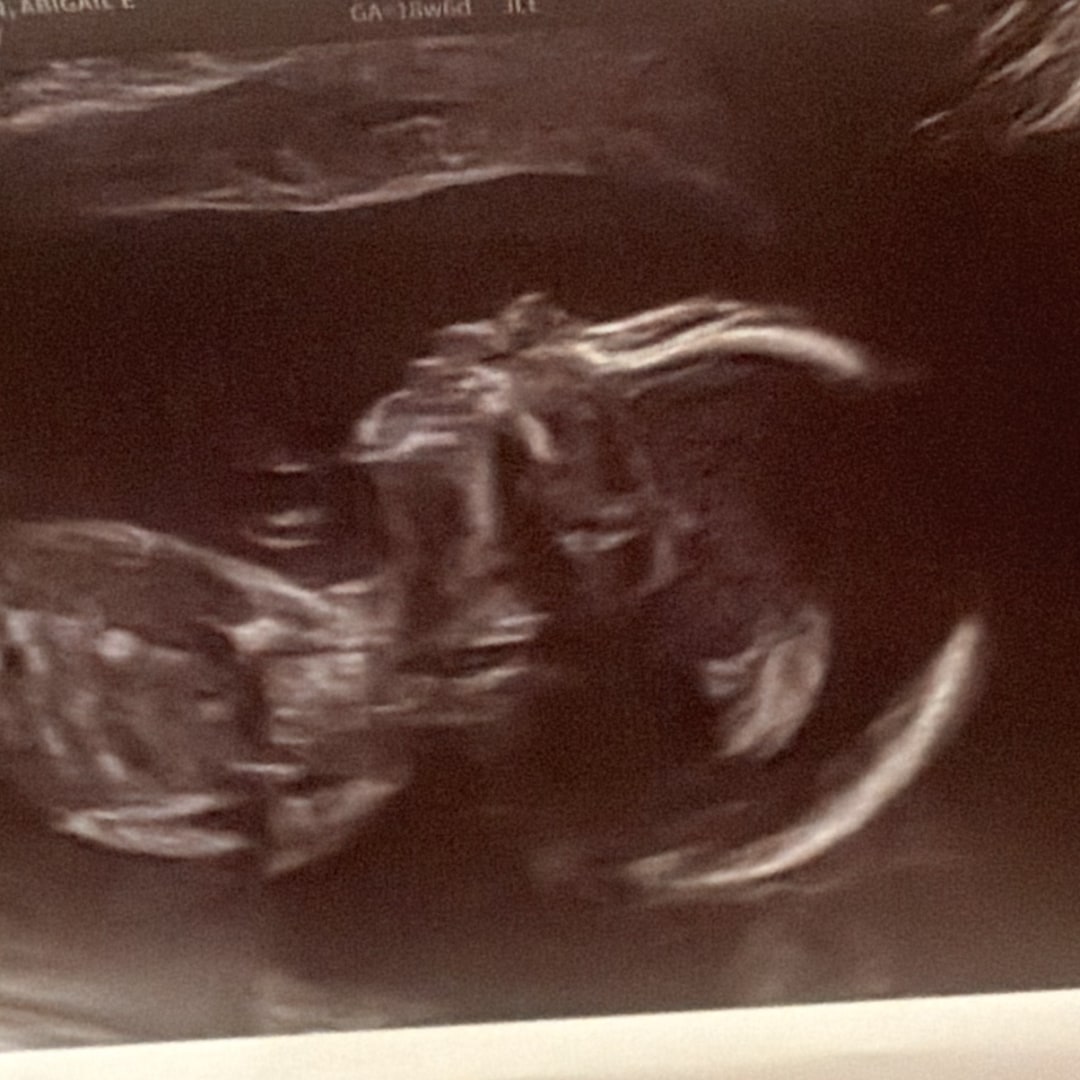 Photo shared by Abigail for their Babylist baby registry.