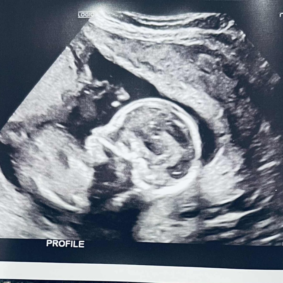 Photo shared by Liza for their Babylist baby registry.