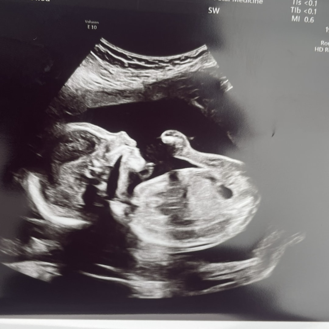 Photo shared by Kat for their Babylist baby registry.