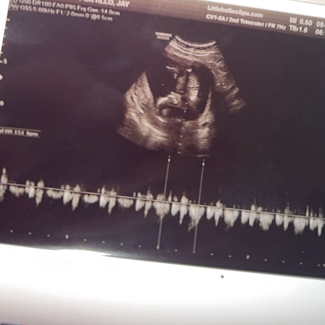 Photo shared by Jay for their Babylist baby registry.