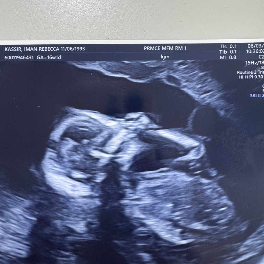 Photo shared by Iman for their Babylist baby registry.