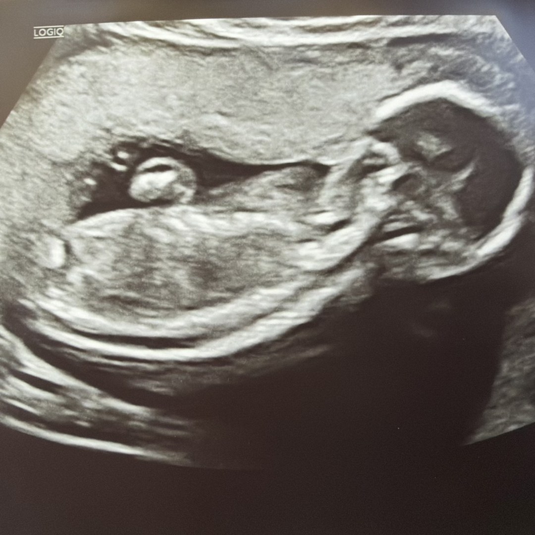 Photo shared by Valentina for their Babylist baby registry.