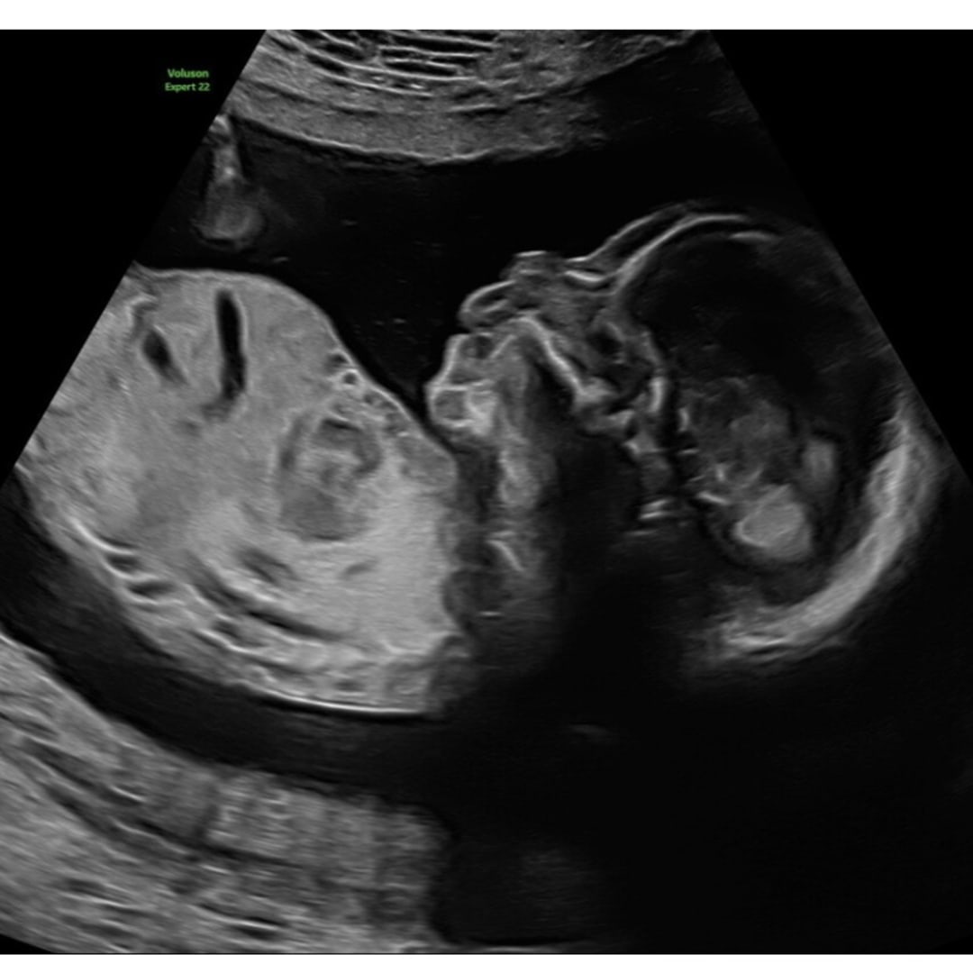 Photo shared by Jaelene for their Babylist baby registry.