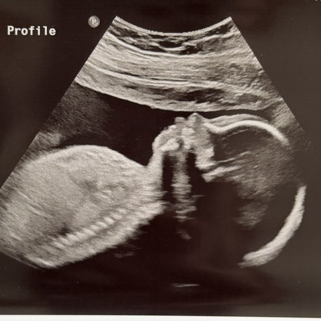 Photo shared by Anna for their Babylist baby registry.