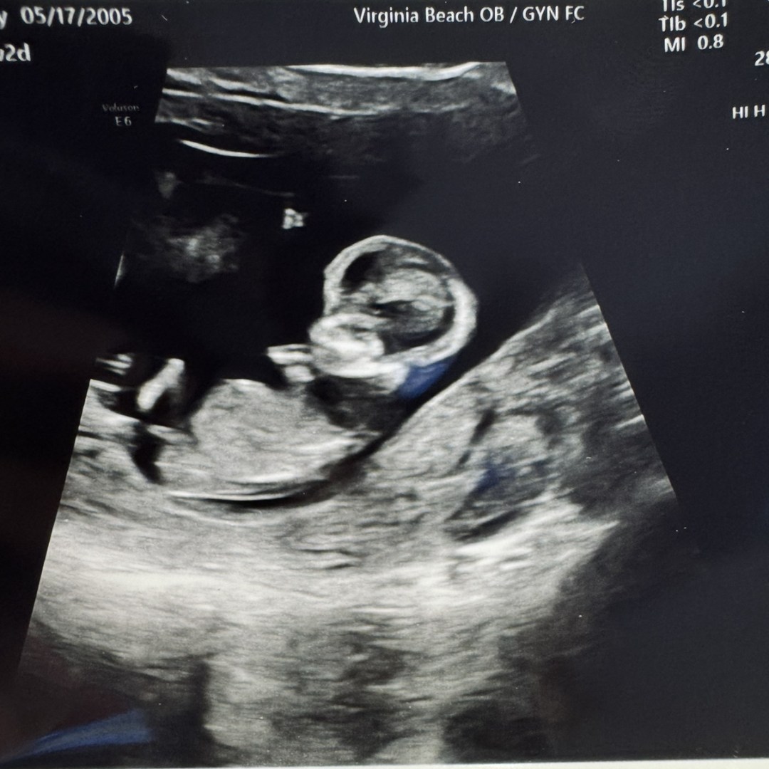 Photo shared by Casey for their Babylist baby registry.