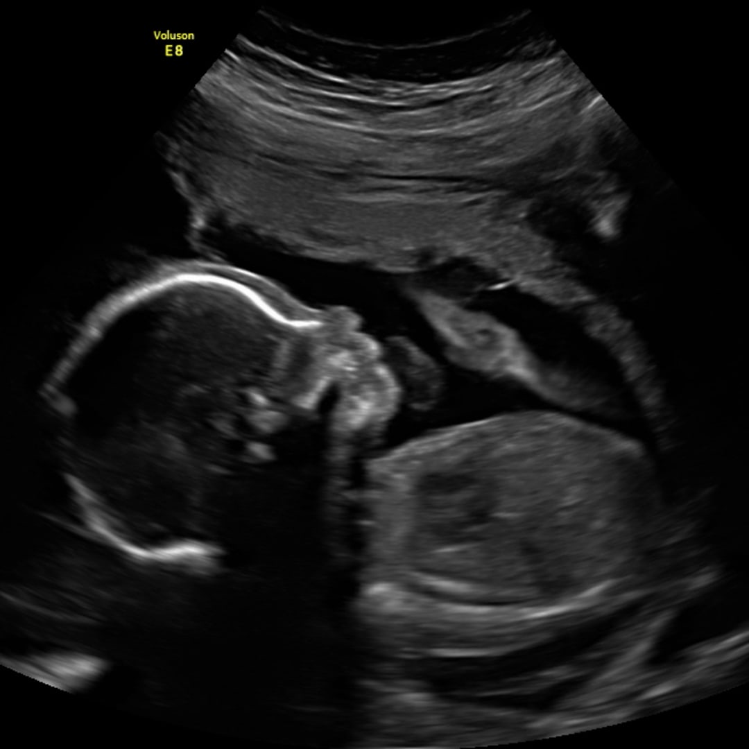 Photo shared by Marianna for their Babylist baby registry.