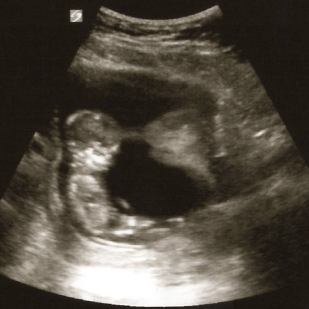 Photo shared by Ashley for their Babylist baby registry.