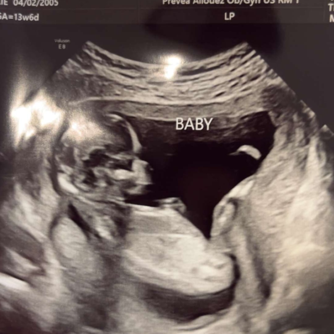 Photo shared by Emilie for their Babylist baby registry.