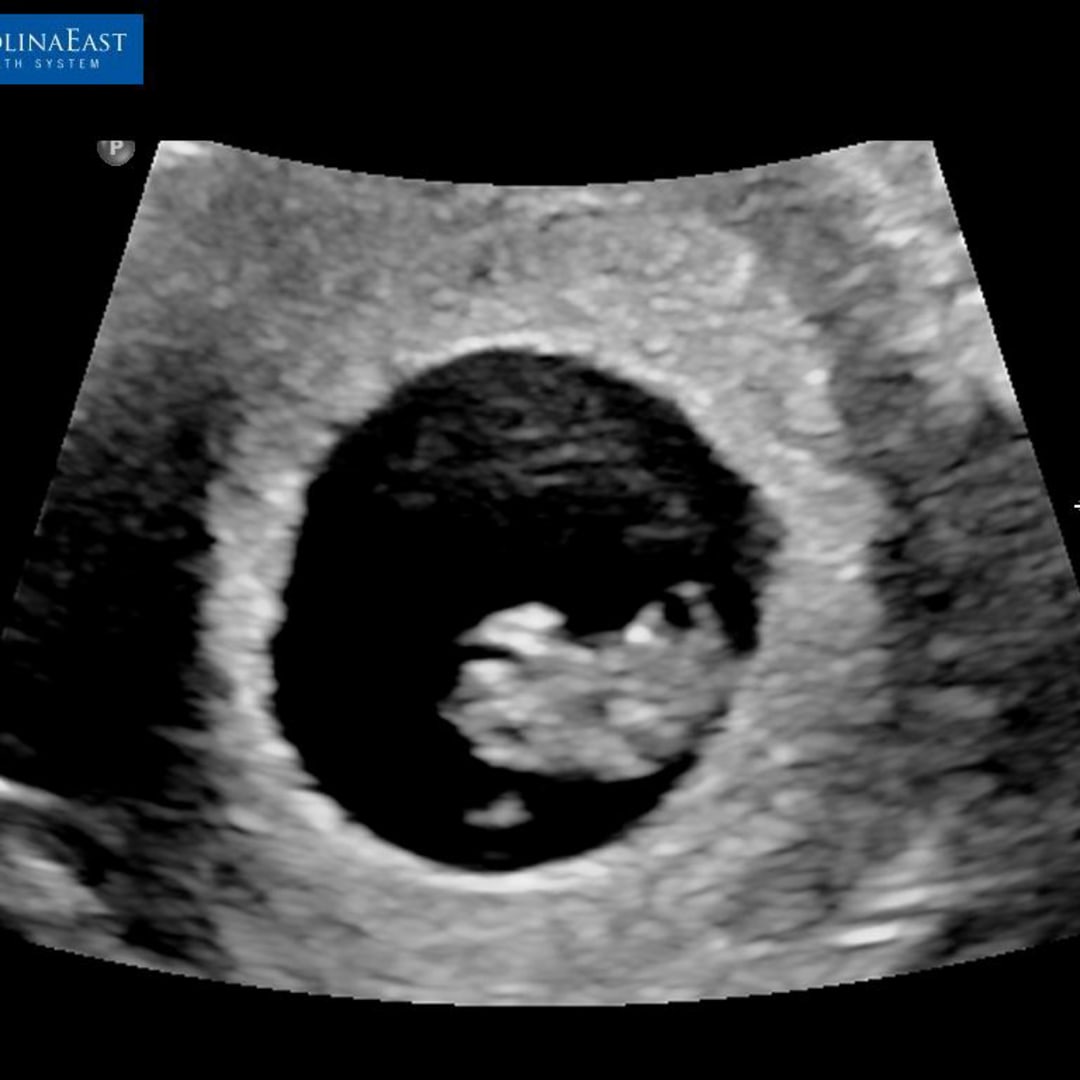 Photo shared by Kinder for their Babylist baby registry.