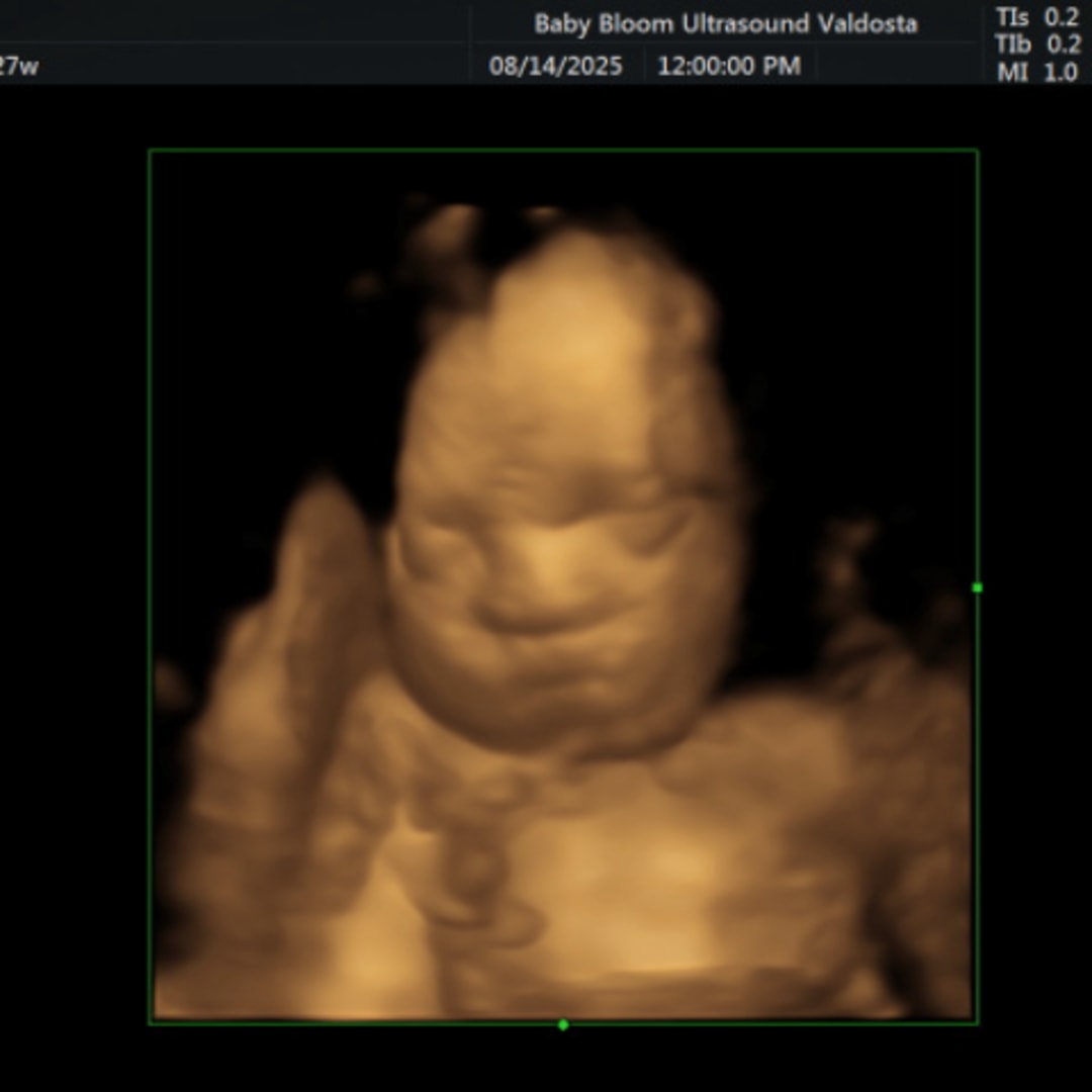 Photo shared by Jayde for their Babylist baby registry.