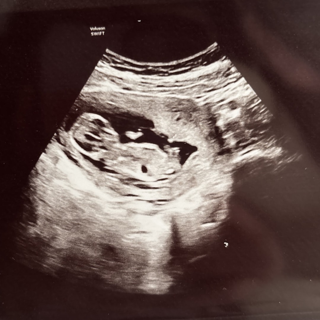 Photo shared by Itzel for their Babylist baby registry.