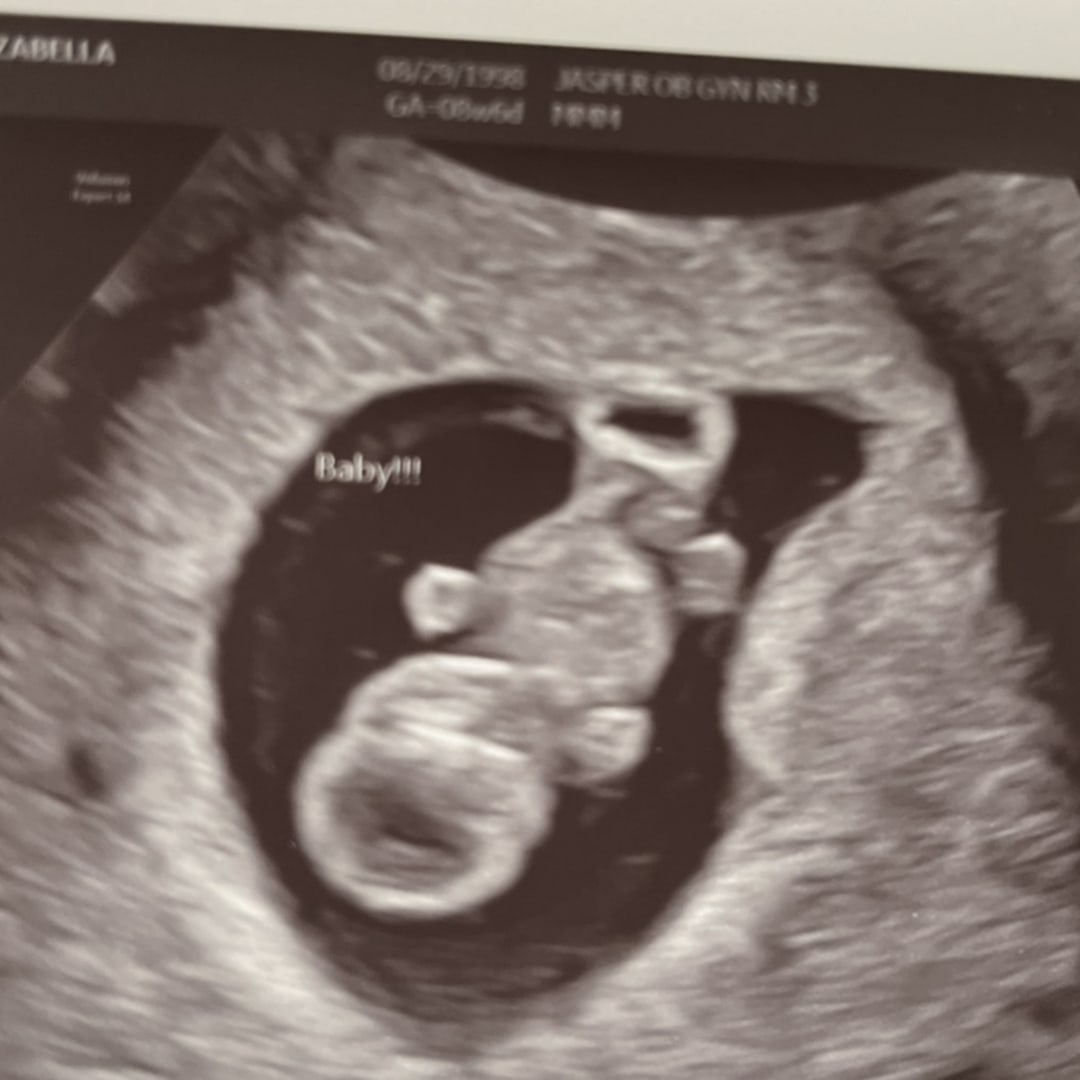 Photo shared by Izabella for their Babylist baby registry.