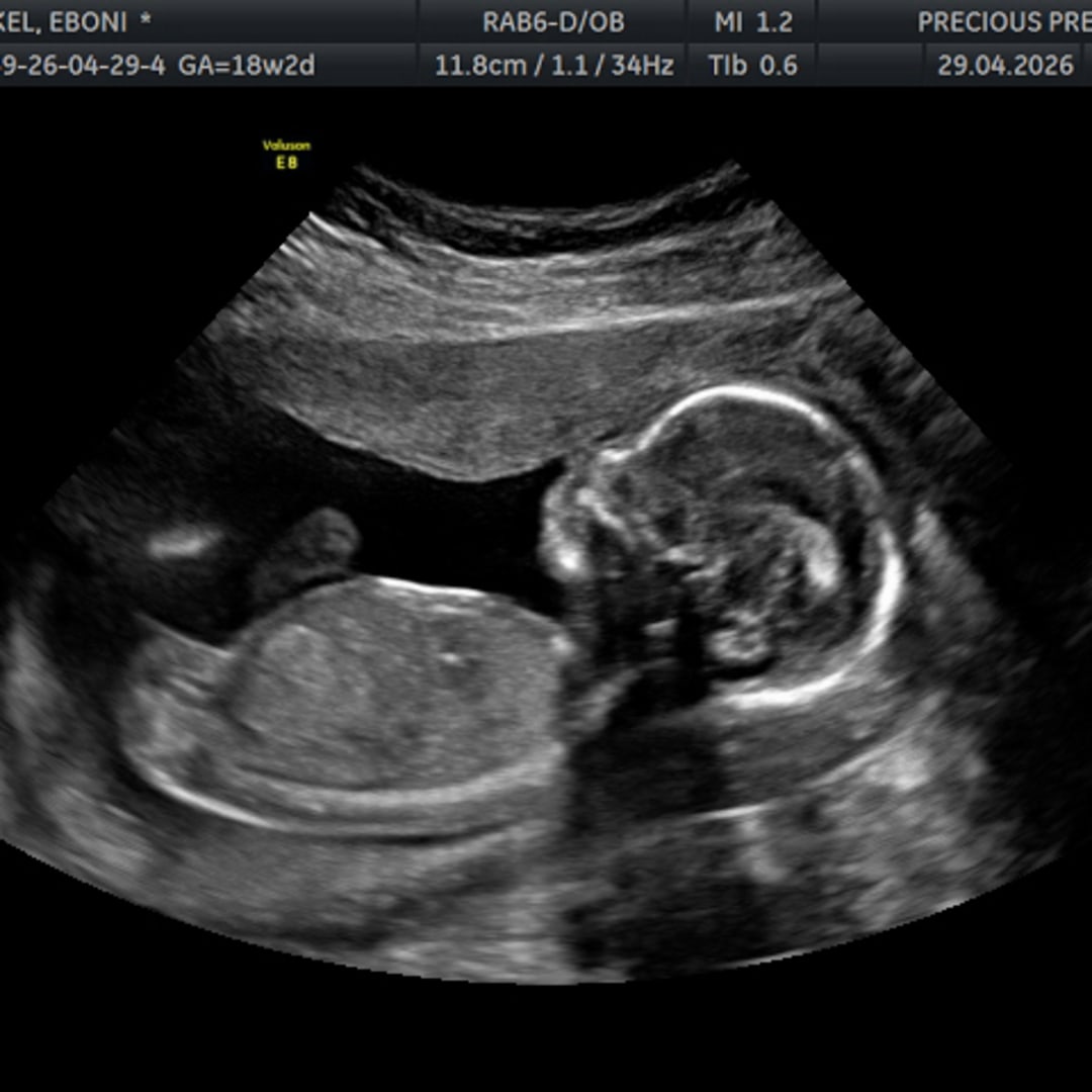 Photo shared by Eboni for their Babylist baby registry.