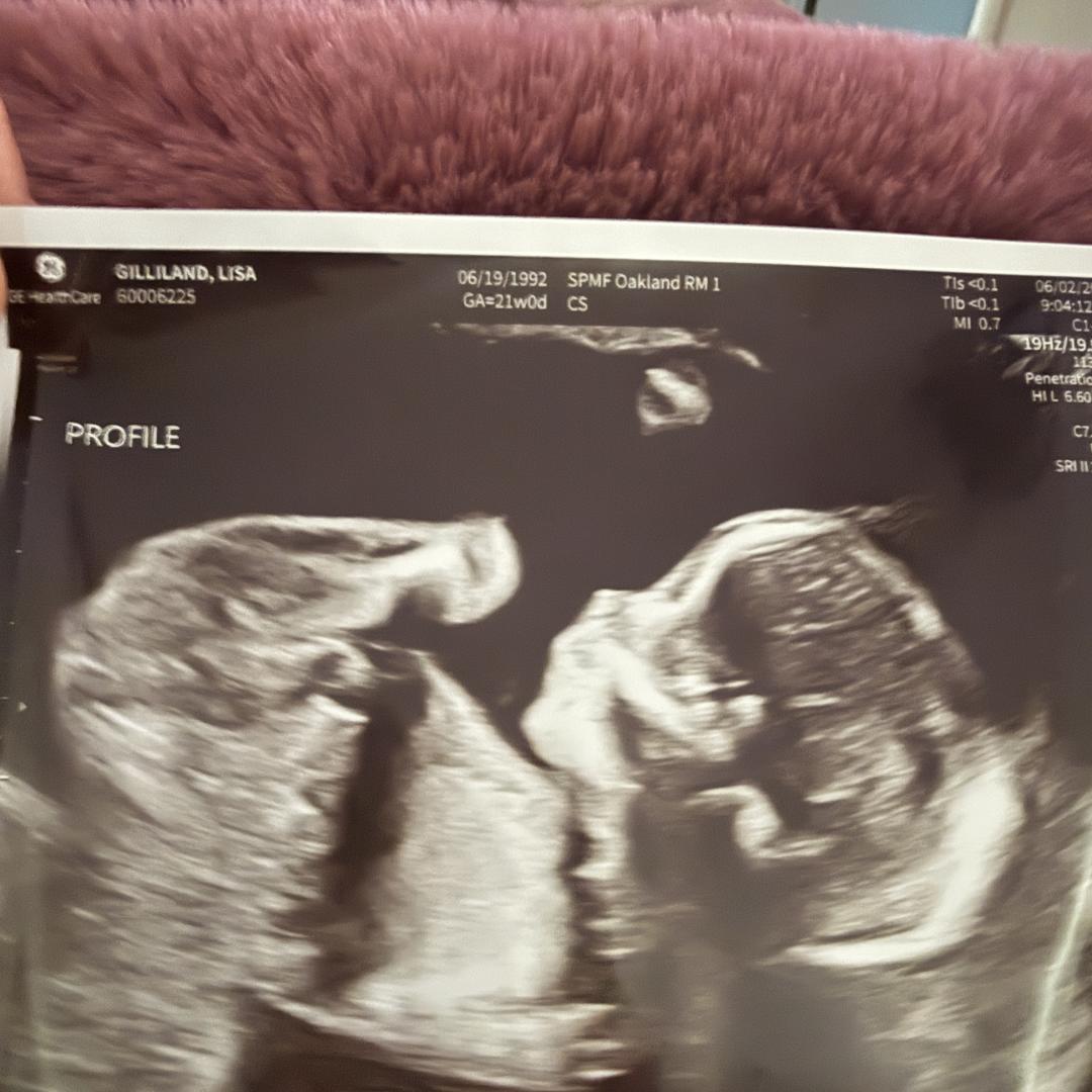 Photo shared by Lisa for their Babylist baby registry.