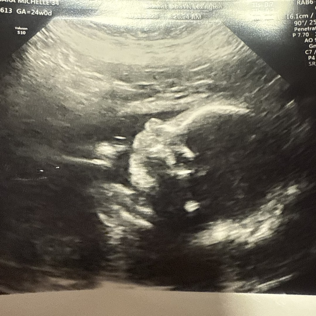 Photo shared by Sara for their Babylist baby registry.