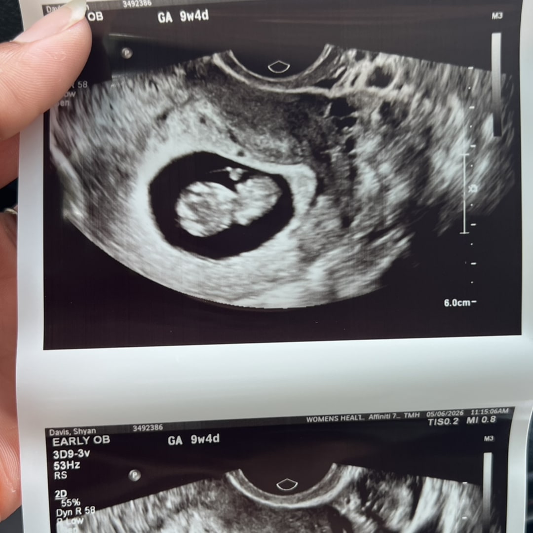 Photo shared by Shyan for their Babylist baby registry.