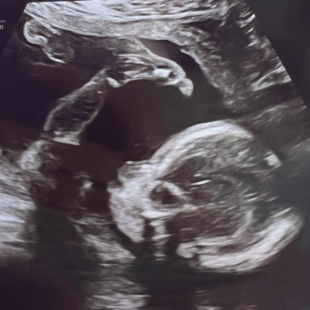 Photo shared by Jen for their Babylist baby registry.