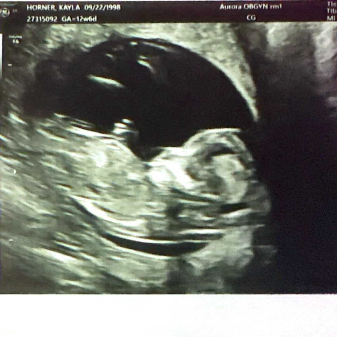 Photo shared by Kayla for their Babylist baby registry.