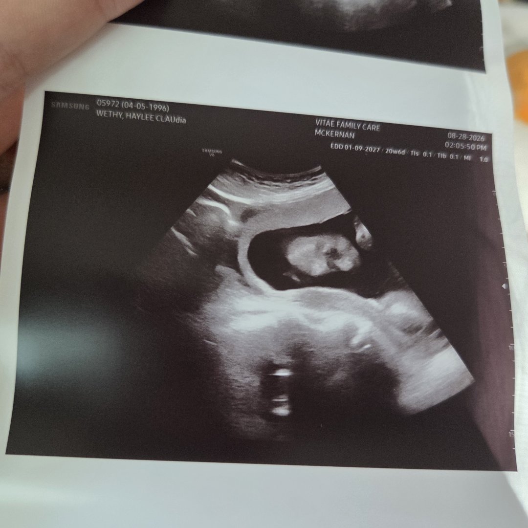 Photo shared by Haylee for their Babylist baby registry.