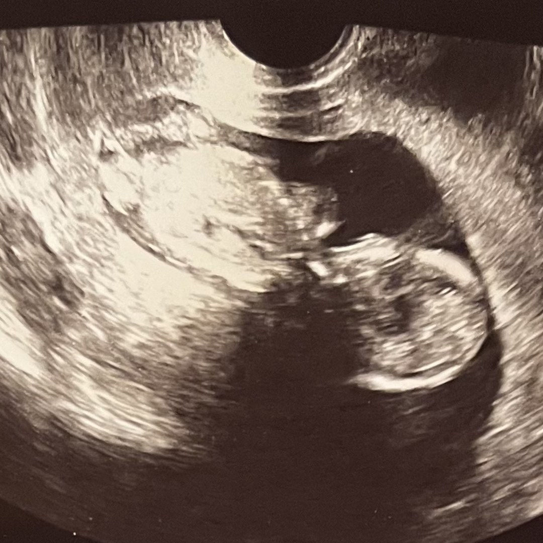 Photo shared by Denisse for their Babylist baby registry.