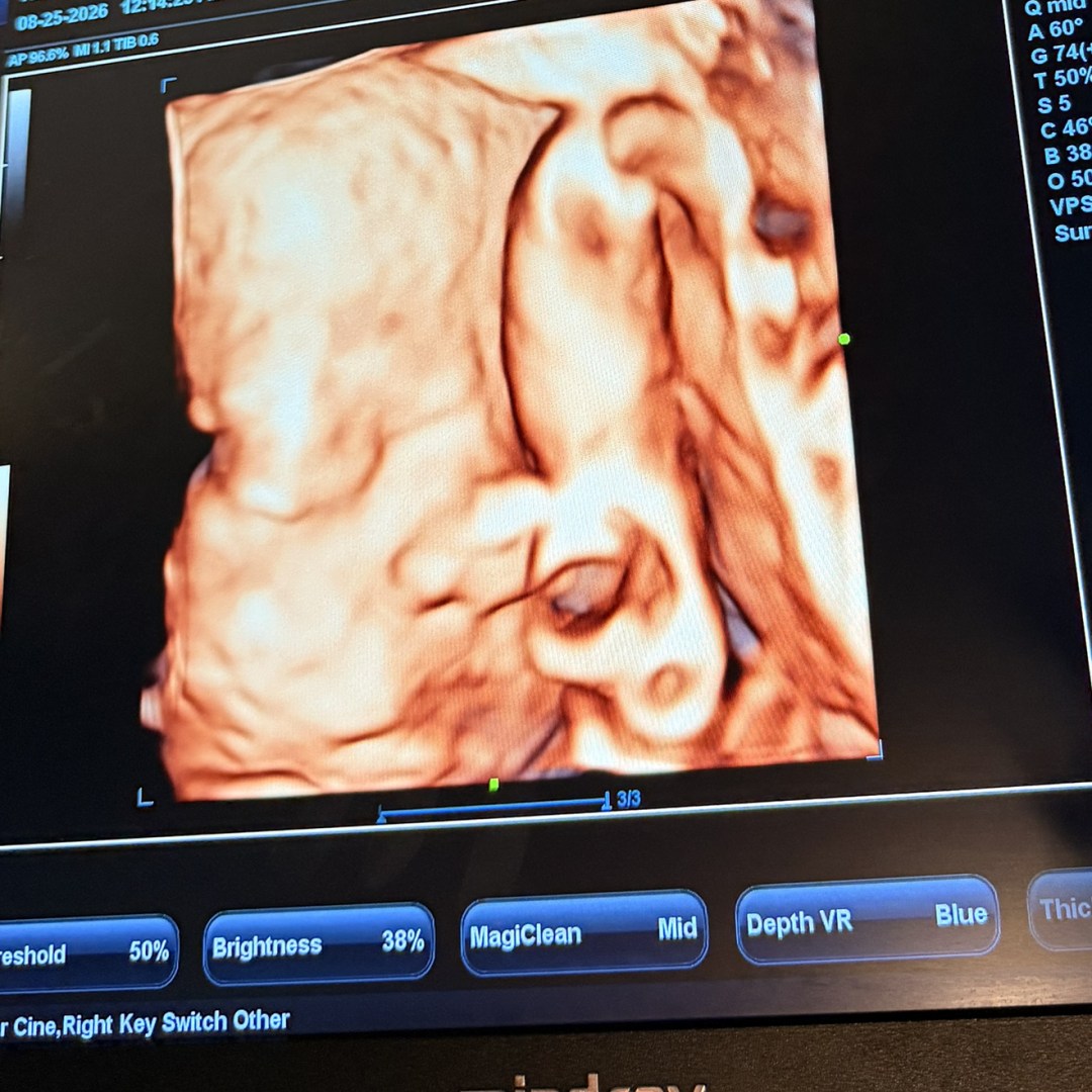 Photo shared by Aileen for their Babylist baby registry.