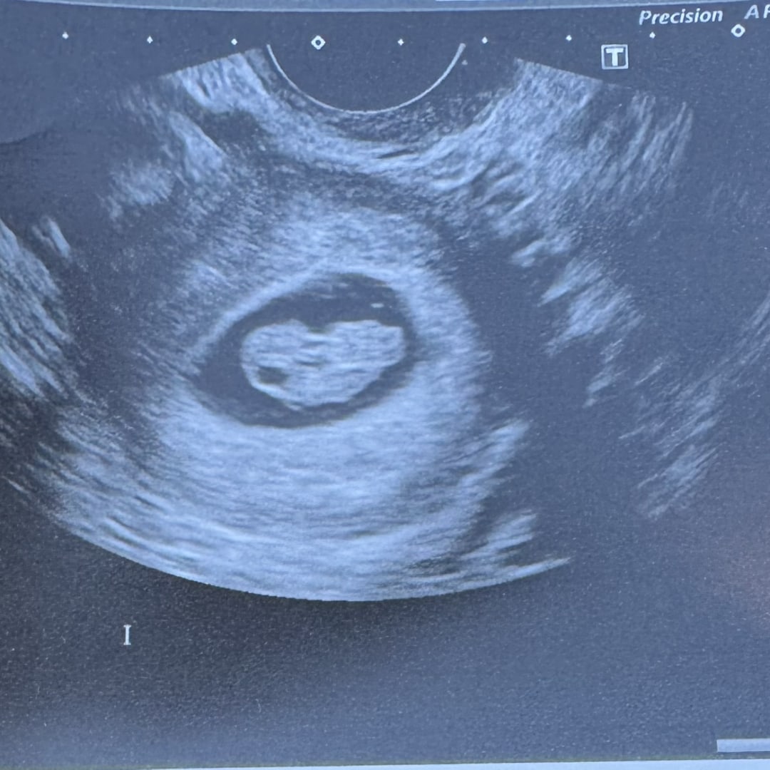 Photo shared by Courtney for their Babylist baby registry.