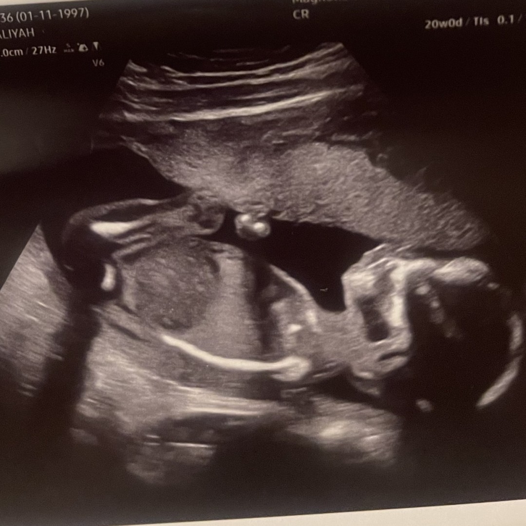 Photo shared by Aaliyah for their Babylist baby registry.