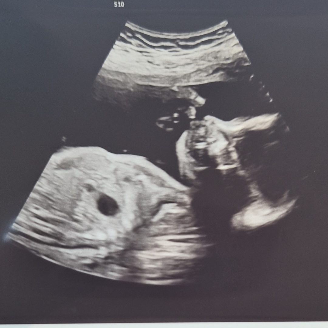 Photo shared by Tiara for their Babylist baby registry.