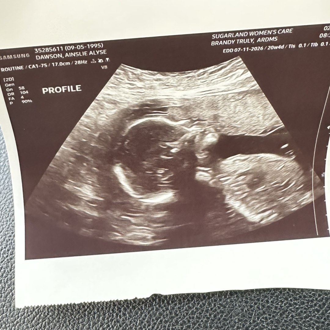 Photo shared by Ainslie for their Babylist baby registry.